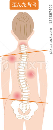 脊椎扭曲的女人 126867402