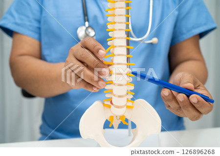 Asian doctor holding spinal nerve and bone model, Lumbar spine displaced herniated disc fragment for treatment medical in the orthopedic department. Asian doctor holding spinal nerve and bone model, Lumbar spine displaced herniated disc fragment for treatment medical in the orthopedic department. 126896268