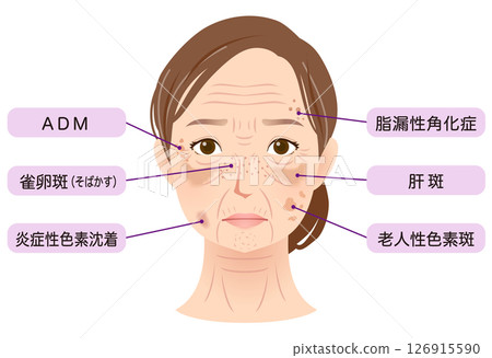女人臉上有斑點，美麗，老年婦女 126915590