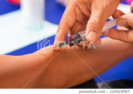 Close up hand collecting blood sample for diagnosis and treatment patient in the hospital.Laboratory technician taking blood for blood chemistry analysis Close up hand collecting blood sample for diagnosis and treatment patient in the hospital.Laboratory technician taking blood for blood chemistry analysis 126928967