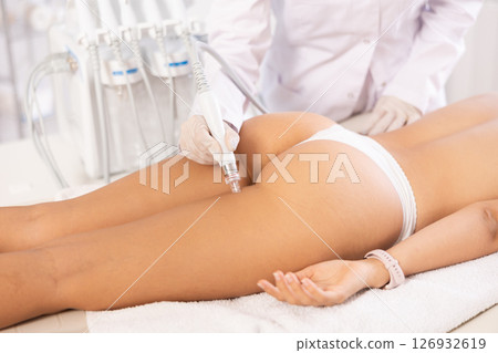 Female client undergoing hardware procedure using ion bubble pen for buttocks 126932619