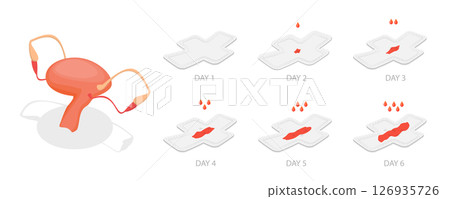 3D Isometric Flat  Illustration of Bleeding Menstrual Period, Women Periods, Menstrual Flow 126935726