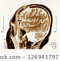 mri scan brain 126943797