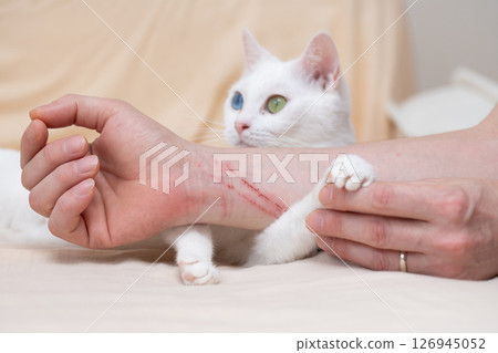 貓咪抓傷了主人的手臂 126945052