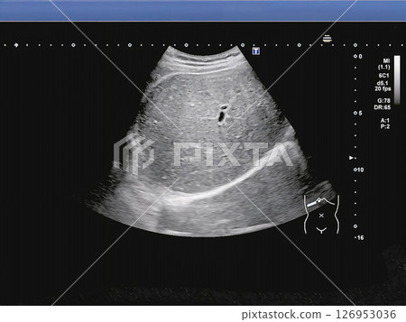 Medical materials for liver ultrasound examination 126953036