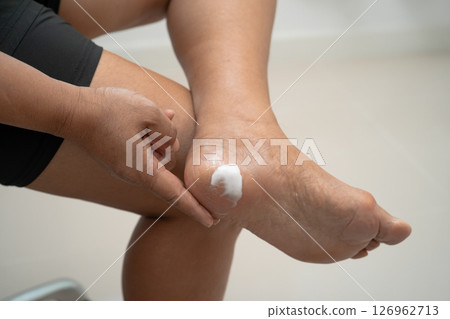Asian woman care feet with cracked and dry heel skin cream at home. Asian woman care feet with cracked and dry heel skin cream at home. 126962713