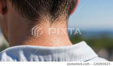 Sweaty neck, hot weather, skin detail 126993625
