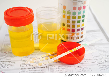 Urinalysis, urine cup for check health examination in laboratory. 127006265