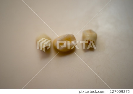 Missing milk teeth 127009275