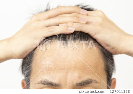 白色背景的中年男子髮際線 127011358