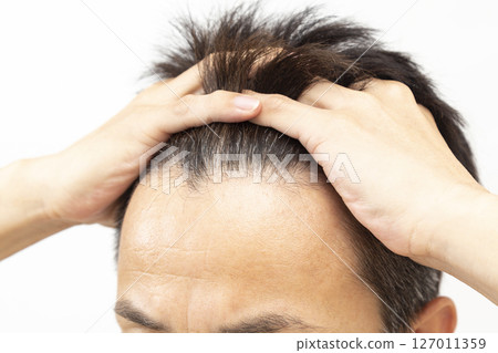 白色背景的中年男子髮際線 白色背景的中年男子髮際線 127011359