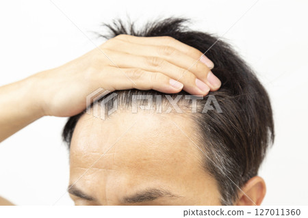 Middle-aged man's forehead on white background 127011360