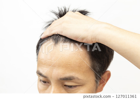 Middle-aged man's forehead on white background 127011361
