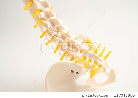 Spinal nerve and bone, Lumbar spine displaced herniated disc fragment, Model for treatment medical in the orthopedic department. Spinal nerve and bone, Lumbar spine displaced herniated disc fragment, Model for treatment medical in the orthopedic department. 127015990