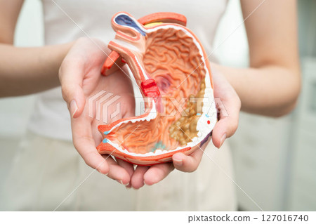 Stomach disease, Asian woman holding anatomy model for study diagnosis and treatment in hospital. Stomach disease, Asian woman holding anatomy model for study diagnosis and treatment in hospital. 127016740