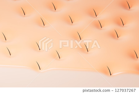 Skin with hair in pores, hair treatment concept, Skin with hair in pores, hair treatment concept, 127037267