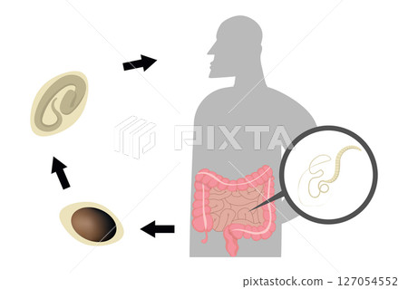 Whipworm lifecycle showing infection of human intestine, trichuris trichiura 127054552