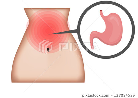 Stomach ache showing highlighted area and close up of organ 127054559
