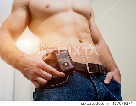 Diabetic man with an insulin pump connected in his abdomen and keeping the insulin pump Diabetic man with an insulin pump connected in his abdomen and keeping the insulin pump 127079274