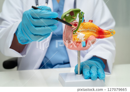 Pancreatitis, pancreatic cancer, Asian doctor with pancreas, gallbladder and bile duct human anatomy model at hospital. 127079665
