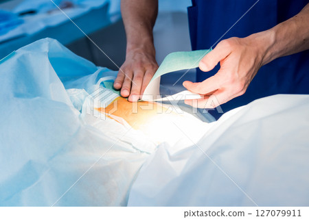 Spinal surgery. Group of surgeons in operating room with surgery equipment. Spinal surgery. Group of surgeons in operating room with surgery equipment. 127079911