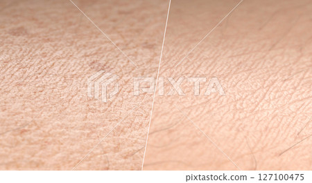 Skin surface young and old aging comparison macro Skin surface young and old aging comparison macro 127100475