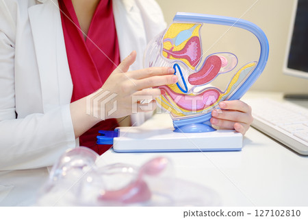 The gynecologist shows the patient an anatomical model of the vagina and talks about the control ring as a means of contraception 127102810