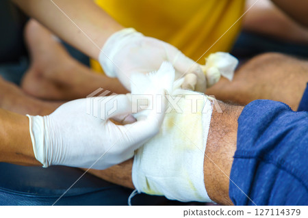 Knee pain in an elderly person use thai herbal compress ball or herbal on knee. Knee pain may cause from muscle strain, tendinosis, Knee osteoarthritis. Thai traditional medicin 127114379