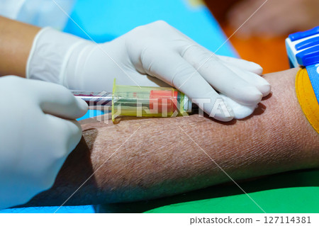 Close up hand collecting blood sample for diagnosis and treatment patient in the hospital.Laboratory technician taking blood for blood chemistry analysis 127114381