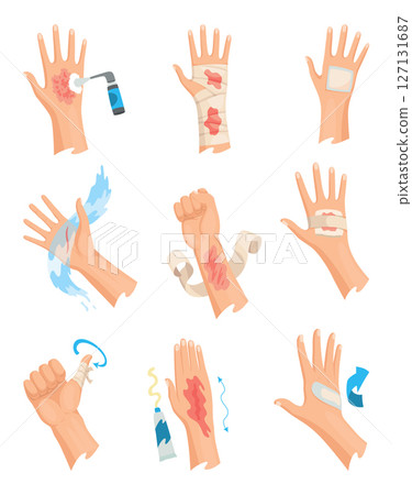 Hands injured skin and procedures of bandaging and wound cleaning. First aid for wound. Medicine cure or treatment. First emergency help for human hand trauma 127131687