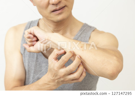 Man scratching insect bites on white background 127147295