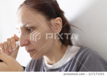 Woman applying ointment on forehead for skin treatment Woman applying ointment on forehead for skin treatment 127171501