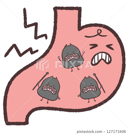 胃中細菌肆虐的插圖 127171606