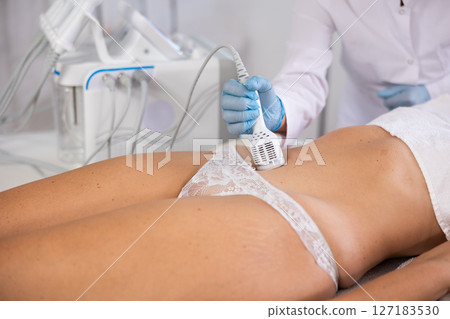 Cosmetologist performing cryotherapy using cooling attachment on female client belly 127183530