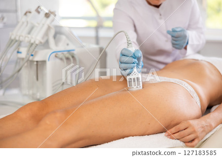 Aesthetician performing cryotherapy using cooling attachment on female client thighs 127183585