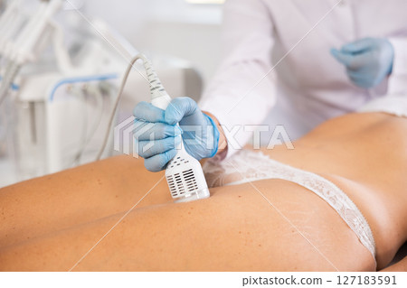 Aesthetician performing cryotherapy using cooling attachment on female client thighs 127183591