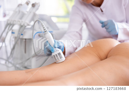 Hardware anti-cellulite procedure on thighs of young woman in beauty clinic Hardware anti-cellulite procedure on thighs of young woman in beauty clinic 127183668