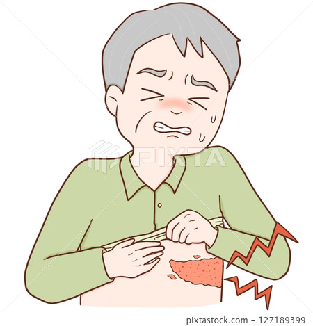 Elderly man with shingles (color) Elderly man with shingles (color) 127189399