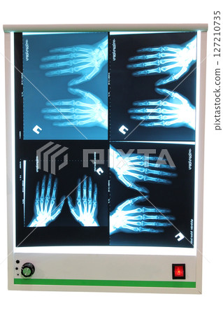 X-ray photograph 127210735