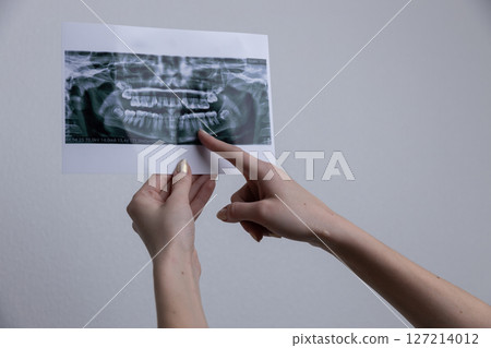 Detailed Dental X-ray Image Being Examined by a Person's Hands Indicating Specific Areas on the X-ray with Fascination and Careful Observation for Dental Health Assessment 127214012