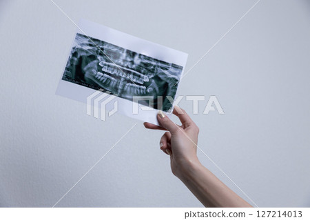Hand Holding Dental X-Ray Image Taken to Analyze Oral Health and Dental Structure with Detailed View of Teeth for Professional Examination in Healthcare Environment Hand Holding Dental X-Ray Image Taken to Analyze Oral Health and Dental Structure with Detailed View of Teeth for Professional Examination in Healthcare Environment 127214013