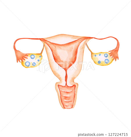 Infertility, pregnancy, female genitals, reproductive system, uterus, watercolor illustration 127224715