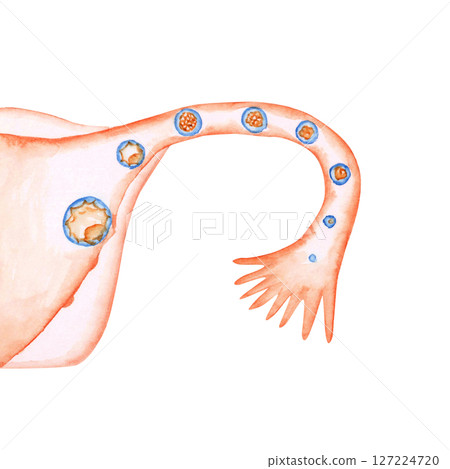 Infertility, pregnancy, uterus, fertilized egg, implantation, watercolor illustration 127224720