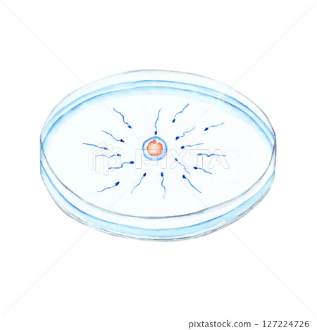 Infertility treatment, pregnancy, in vitro fertilization, furikake method, watercolor illustration 127224726