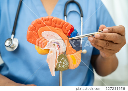 Alzheimer disease, Asian doctor holding brain anatomy model for study diagnosis and treatment in hospital. 127231656