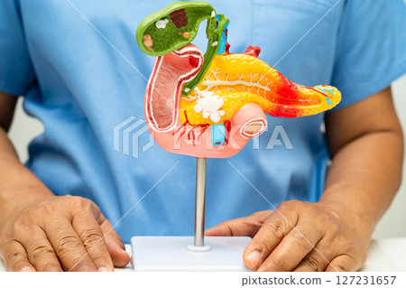 Pancreatitis, pancreatic cancer, Asian doctor with pancreas, gallbladder and bile duct human anatomy model at hospital. 127231657