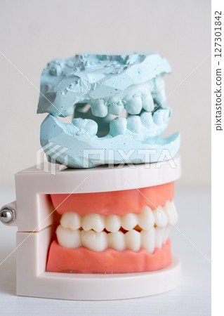 Dental Model and Plaster Cast of Human Teeth Dental Model and Plaster Cast of Human Teeth 127301842