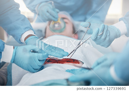 Hands, blood and operation with a team of doctors at work during surgery with equipment or a tool in a hospital. Doctor, nurse and collaboration with a medicine professional group saving a life 127339691