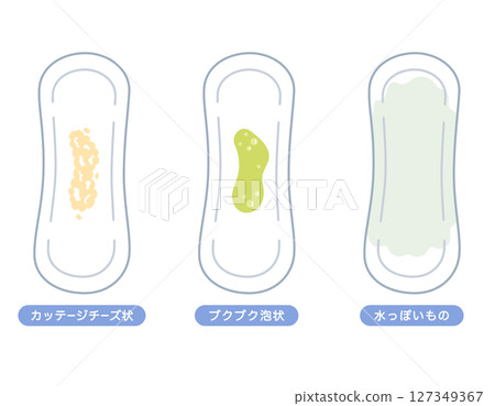 女性健康:陰道分泌物種類、衛生棉 女性健康:陰道分泌物種類、衛生棉 127349367