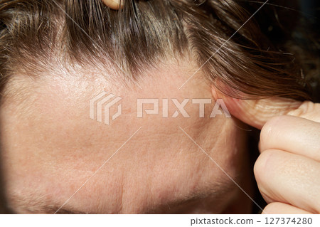 Close-up of young caucasian female showing scalp with light brown hair Close-up of young caucasian female showing scalp with light brown hair 127374280